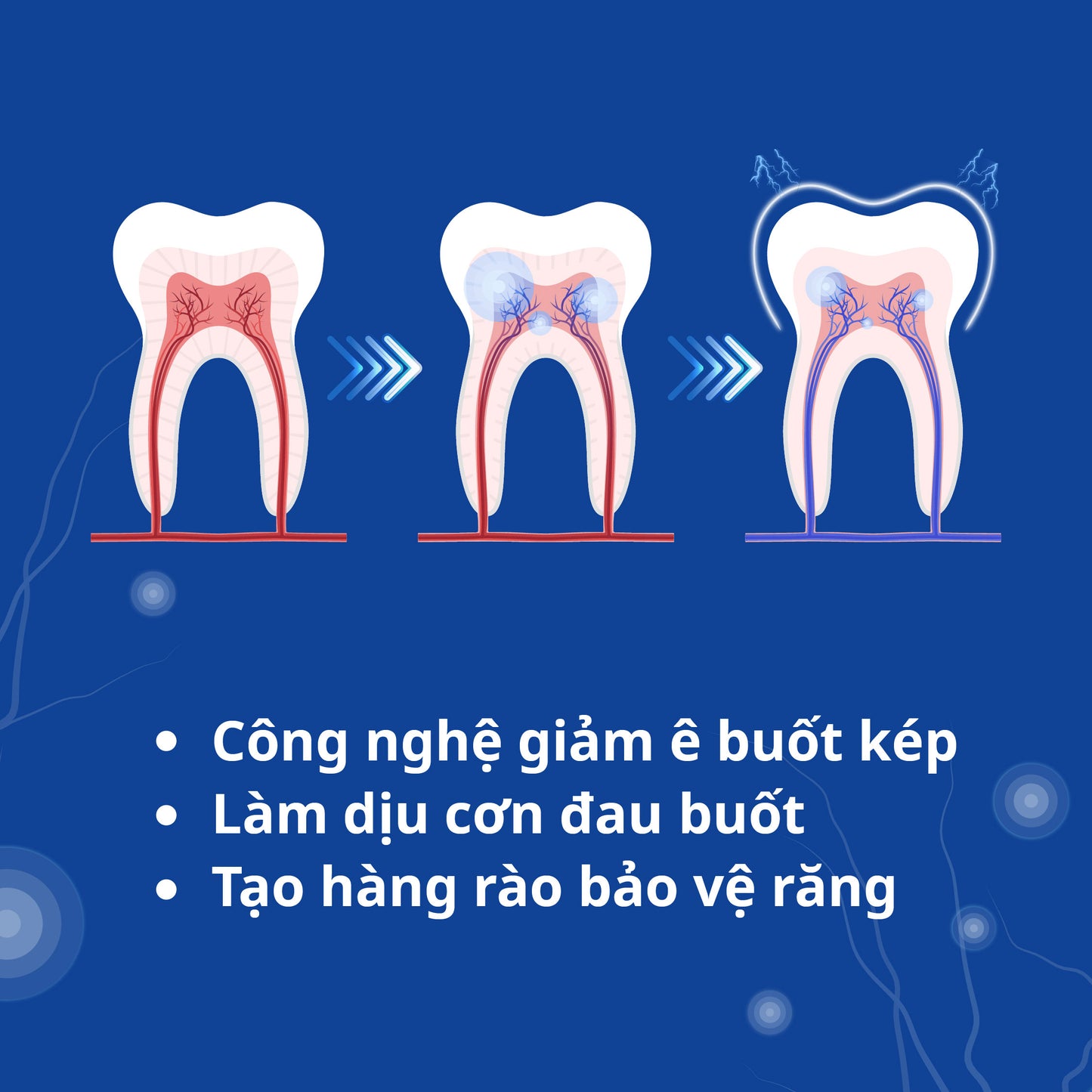 [MỚI] Kem Đánh Răng Cho Răng Nhạy Cảm Zenyum Relief + Guard Sensitivity 100g